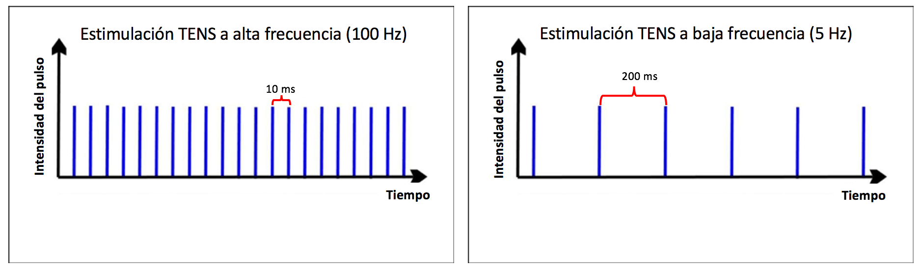 electroestimulador formas de onda