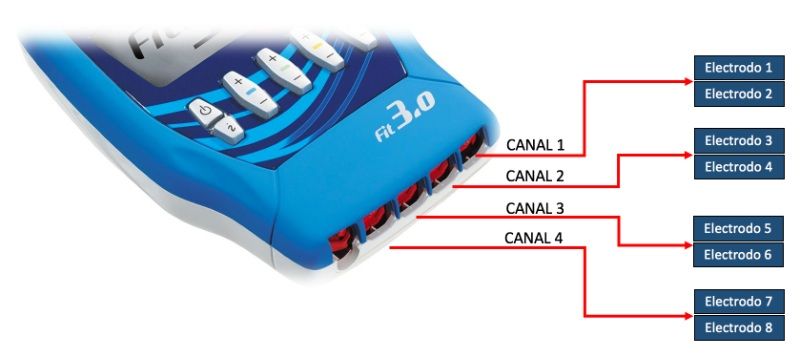 electroestimulador-canales 2