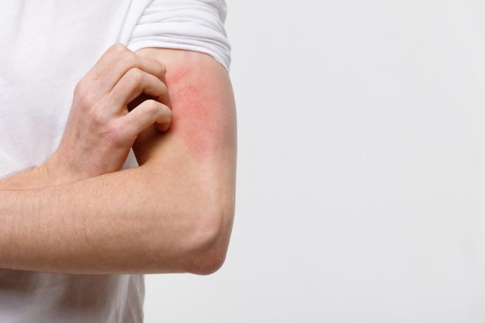 cinta-kinesiologica-cerca-macho-rascarse-picazon-mano-aislado-sobre-fondo-gris