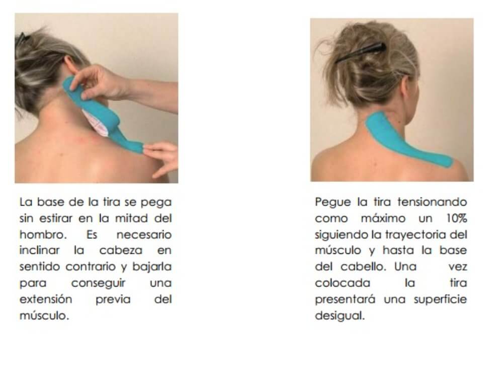 cinta-kinesiologica-kinesiotape_ejemplo_1