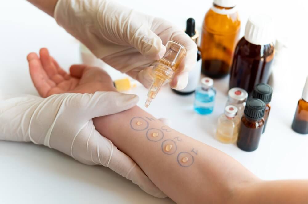 cinta-kinesiologica-prueba-reaccion-alergica-cutanea-brazo-persona